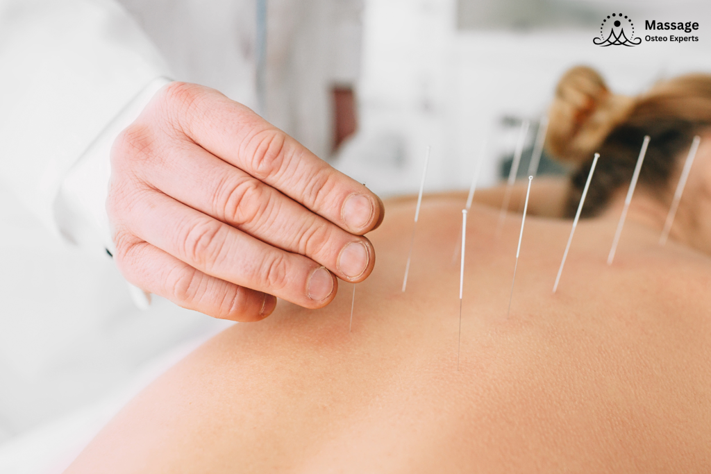 Acupunture in Port Credit