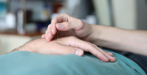 Acupunture healing port credit
