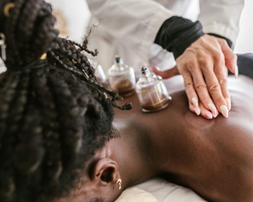Cupping Massage Therapy in Port Credit